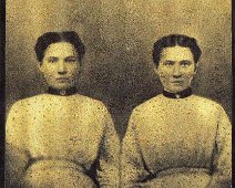 Riley Allen's Twins - Ada and Ida Allen